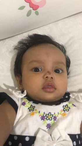 Anak jatuh dari tempat tidur