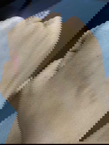 แม่ๆบ้านไหนเป็นแบบนี้บ้างคะ?