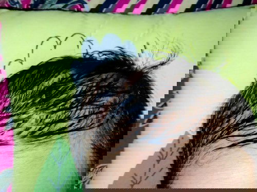 Bun kepala ank saya benjol sebelah kanan klo di pegang lembek kira" bisa hilang gk y,ini sdh 23 hari