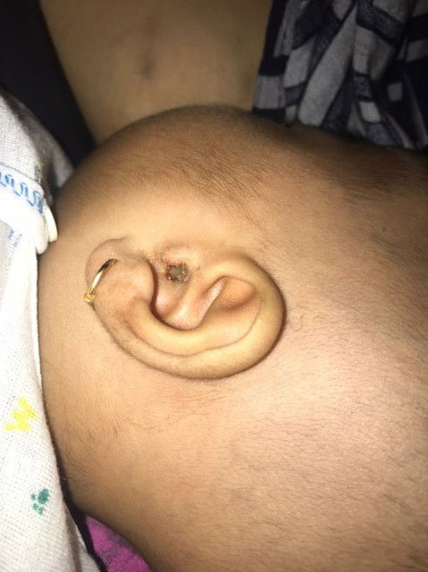 Telinga keluar cairan