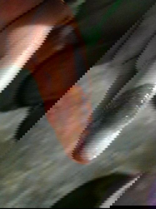 จะเป็นไรไหม