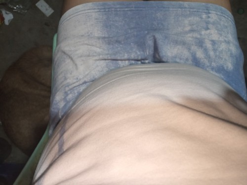 normal po ba na sumasakit ang mga singit singit ng hita sa pagbubuntis , salamat po sa sasagot😊