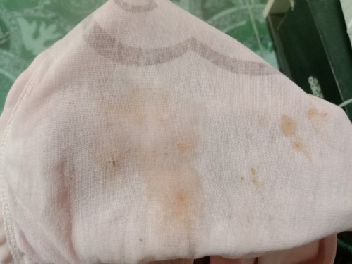 เมื่อวานมีมูกใส แต่วันนี้มีมูกสีน้ำตาลต้องไปหาหมอมั้ยคะ ยังไม่ปวดท้อง 35+4