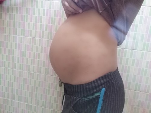 24สัปดาห์2วัน