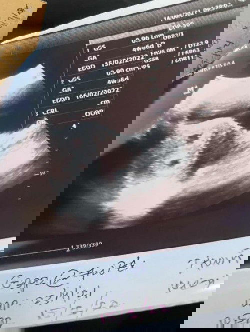 Mengandung baby kembar