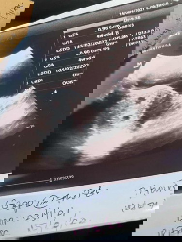 Mengandung baby kembar