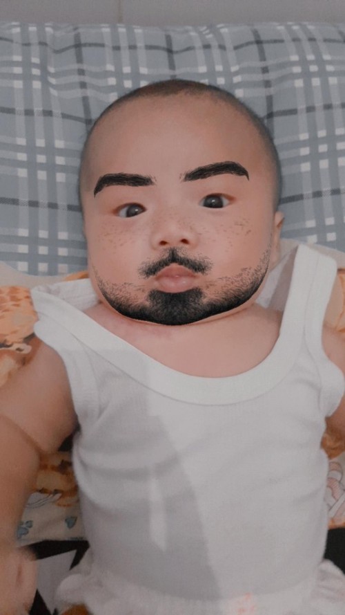 Apakah normal mata bayi 3 bulan masih seperti ini?