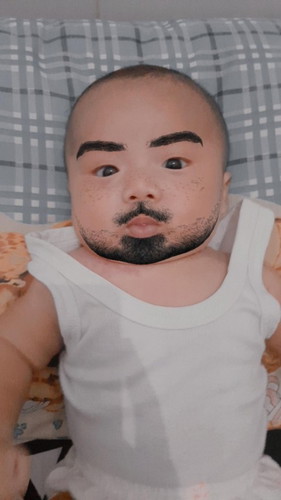 Apakah normal mata bayi 3 bulan masih seperti ini?