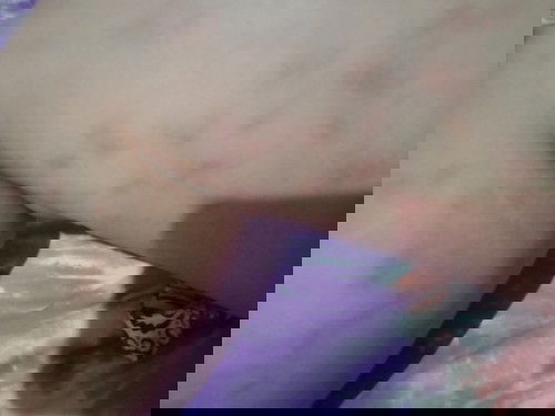 Hilangin stretchmark melahirkan