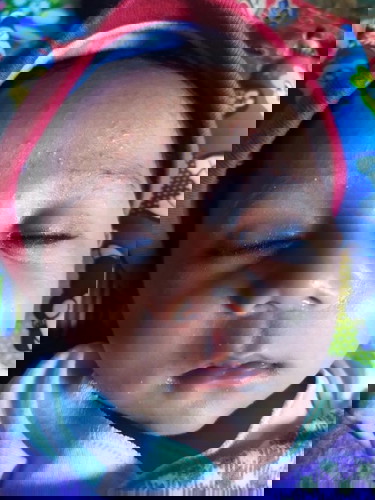 Bintik bintik merah