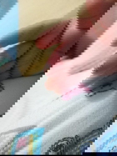 Sugat ni baby (7months old)