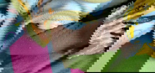 Solusi Kulit Brutusan Seperti Cacar Air