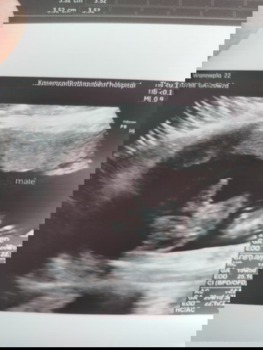 บ้านไหนให้เห็นชัดแบบบ้านนี้มั้งค่ะ
ไม่ให้แม่ลุ้นเลยค่ะบ้านนี้