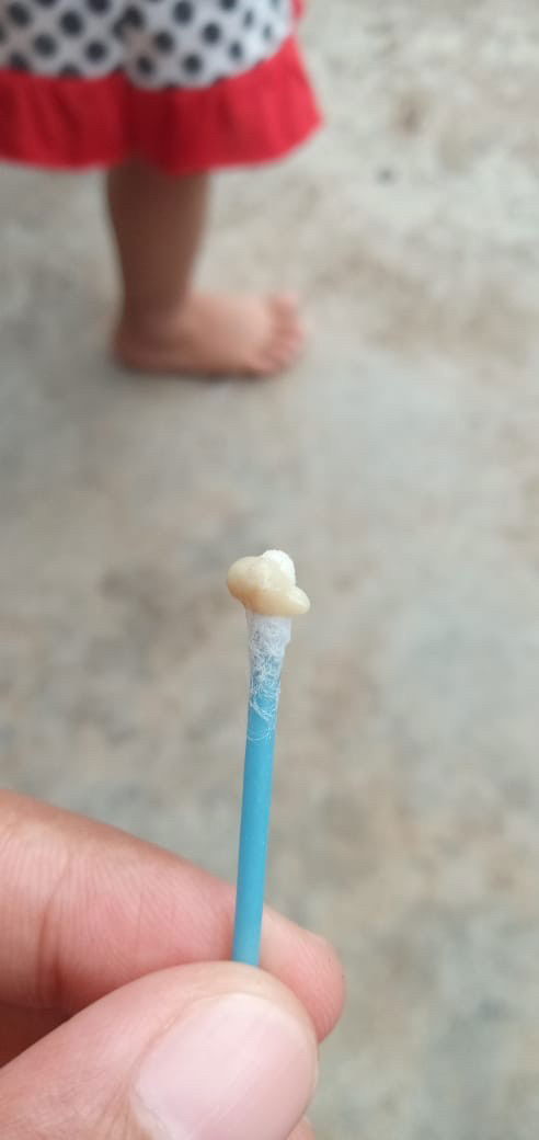 Bayi usia 1 th 2 bln