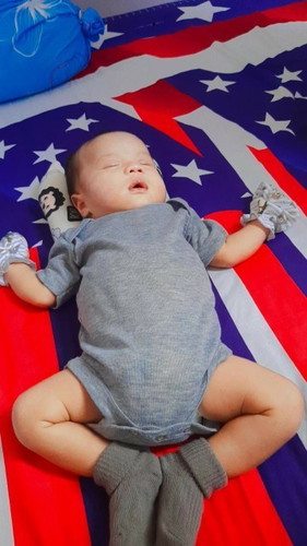 Tenggorokan berlendir bayi 2bln