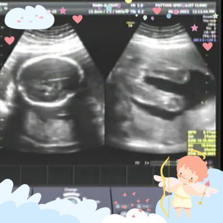 ช่วยตั้งชื่อให้หนูหน่อยค่ะแม่ๆๆ🥰
ลูกสาว ทีมตุลาคมค่ะ🙏🏻