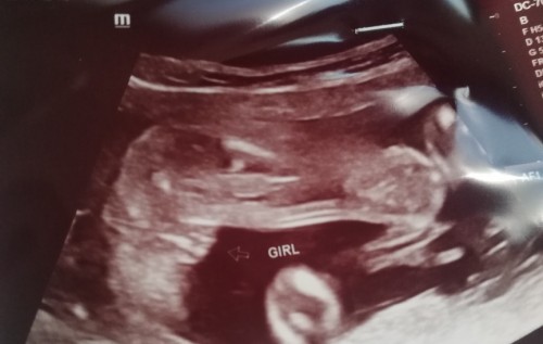 Scan girl boleh jd boy ke ek kua nt