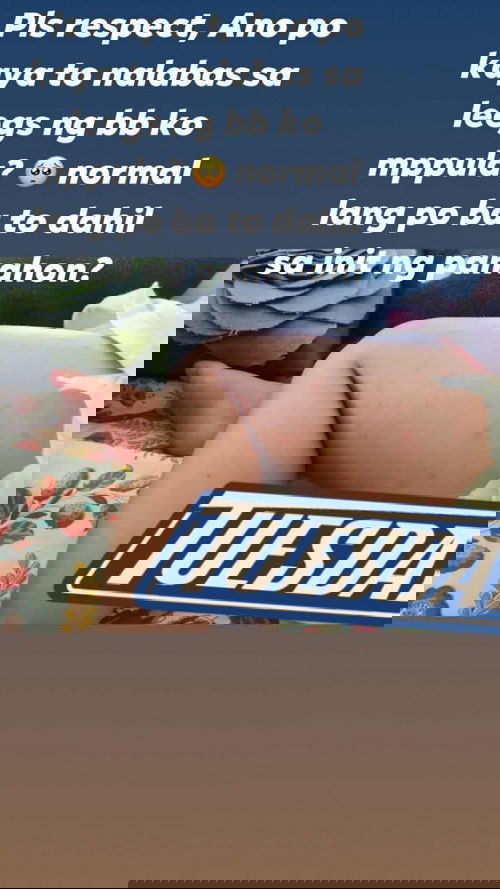 Pantal sa katawan ni baby