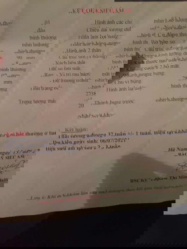 Xin ý kiến mọi người