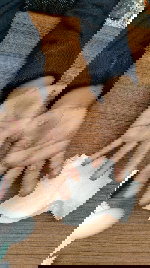 Luka gatel jd bernanah