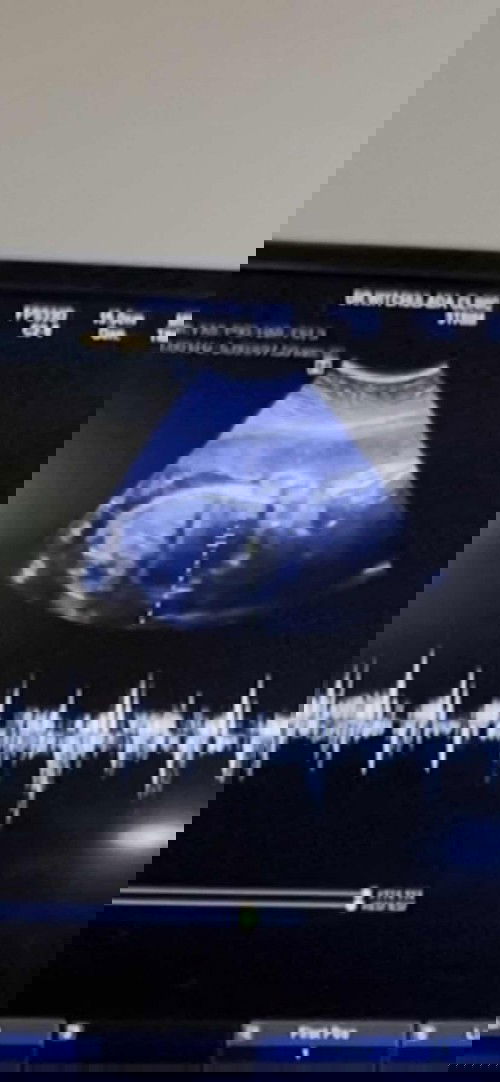 27w 
แล้วจ้าวันนี้ไปซาวมา ป้าหมอบอกหนัก1148กรัม แบบนี้เรียก1โลกี่ขีดคะเรียกแบบไหนได้บ้างคะ