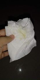 แม่บ้านไหนเคยมีตกขาวแบบนี้ไหมคะ?