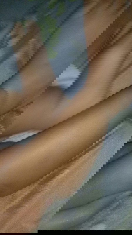 Bekas gigitan nyamuk