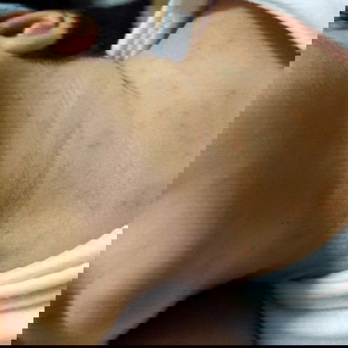 Ano po kayang mga yan na nasa leeg ni baby? Ano po pampaalis ng ganyan?