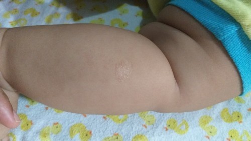 kulit bayi