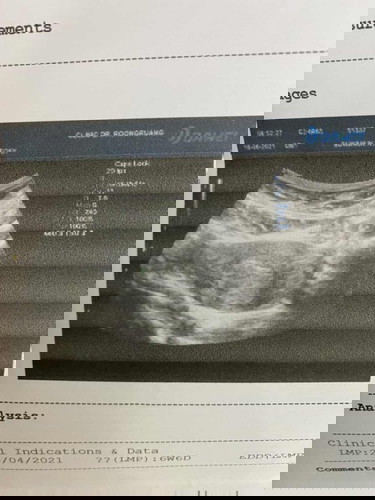 6week ยังไม่เจอตัวน้องค่ะ