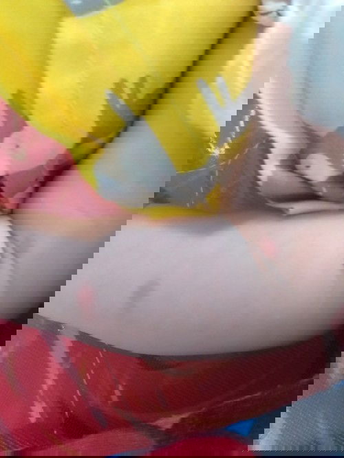 Bé bị kiến với muỗi cắn như này.có hết mấn đỏ k ạ.hay để lại z qai ạ