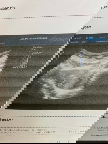 6week ยังไม่เจอตัวอ่อนเลยค่ะ