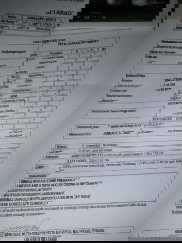 share ko lang tong ultrasound ko no need to worry ba mga ka nanay, nirisetahan nmn na ako ng ob..