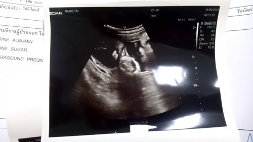 ผช.ใช่ไหมคะเเบบนี้