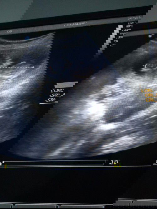 nih mo nanya bun,baiknya gmn?