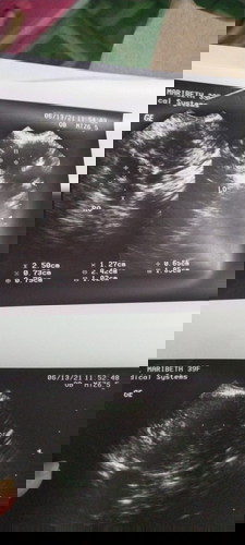 #first baby... Ask quh lng po kng anu po masasabi nyu sa transV quh... Salamat po