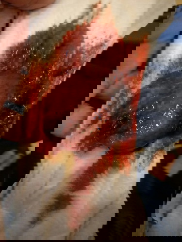 สอบถามแม่หลังคลอดมีก้อนแบบนี้หลุดมาพร้อมน้ำคาวปลา