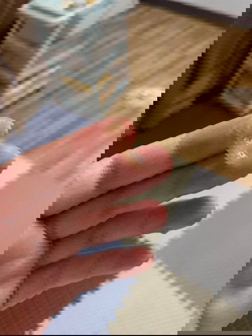 ท้อง 39 w 1D มีอาการมูกน้ำตาลออกมาเรื่อยๆ