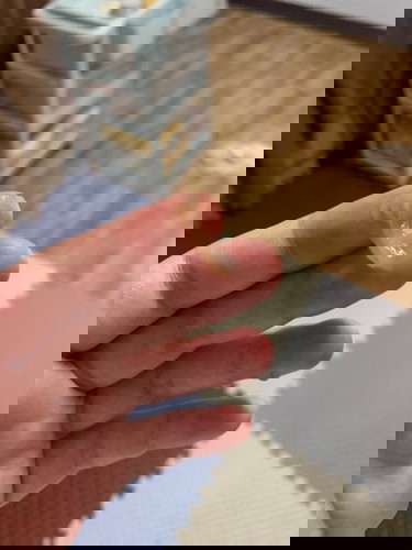 ท้อง 39 w 1D มีอาการมูกน้ำตาลออกมาเรื่อยๆ