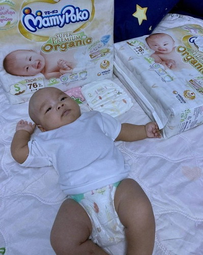 เล่าประสบการณ์ มุมมองคุณแม่