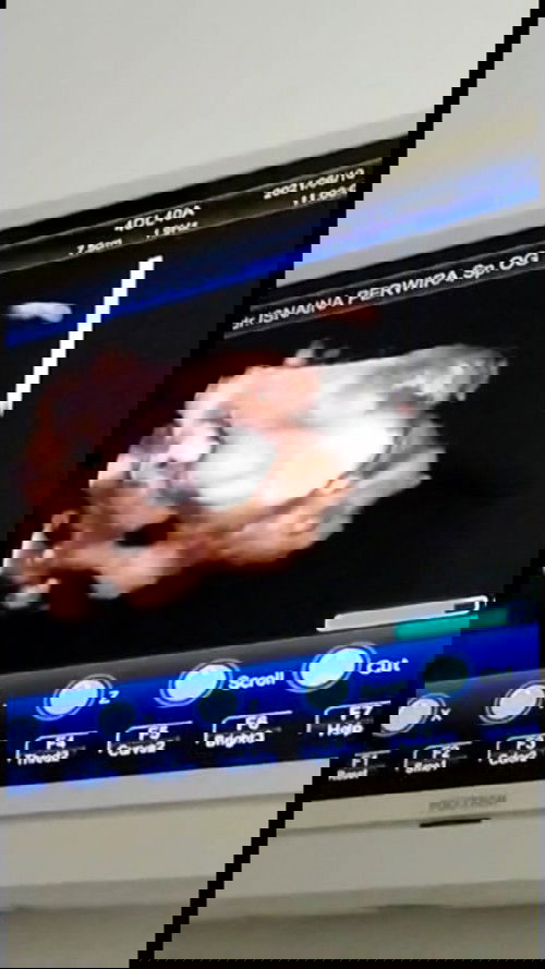 Deg-dekan pas dibilang dokterny kurang minum susu. Pdhal selama hamil saya nek bngt sma susu.