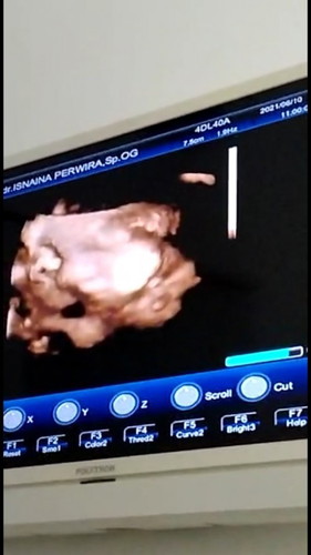 Deg-dekan pas dibilang dokterny kurang minum susu. Pdhal selama hamil saya nek bngt sma susu.