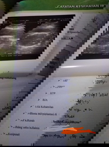 Usia kandunganku 8 bulan beberapa hari ini bayinya gak gerak gerak saya harus bagaimana