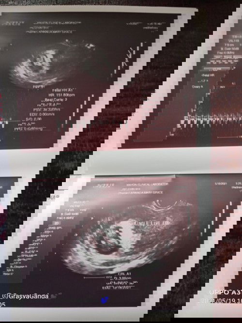 Checking of ultrasound