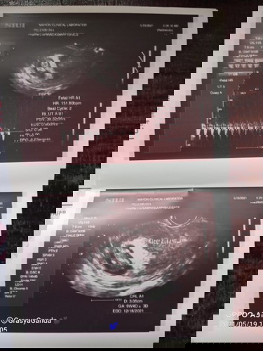 Checking of ultrasound