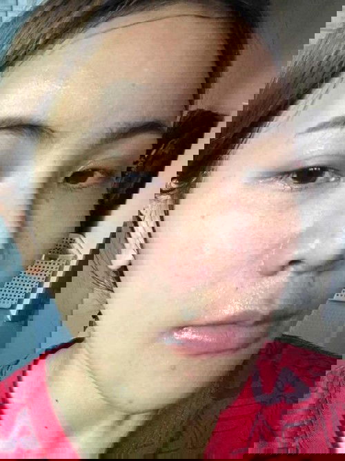 แม่ตั้งครรภ์อยากสวย 😬