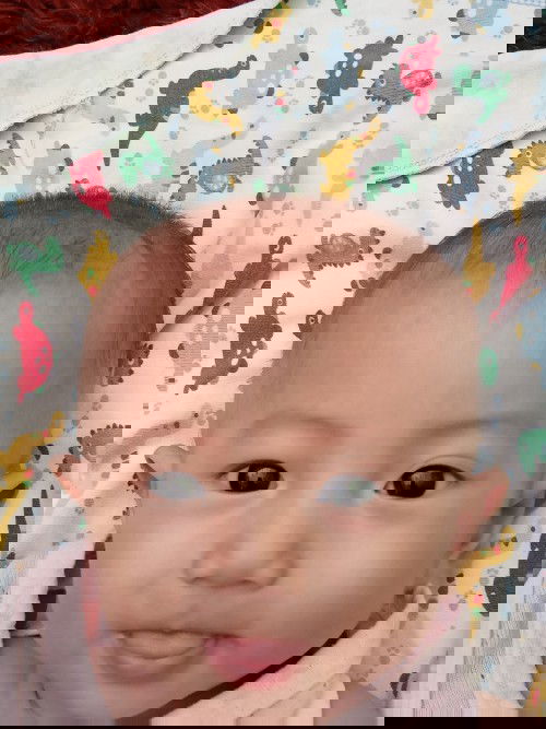 Garis menonjol di kepala bayi