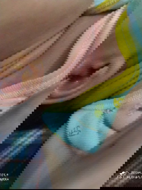 Leher merah dan ada kaya kuning" gitu