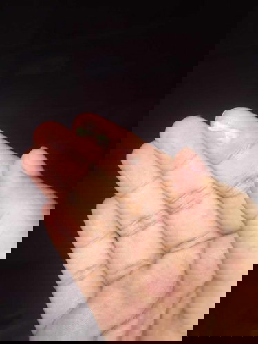 Discharge or mucus plug?