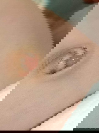 Baby's belly button